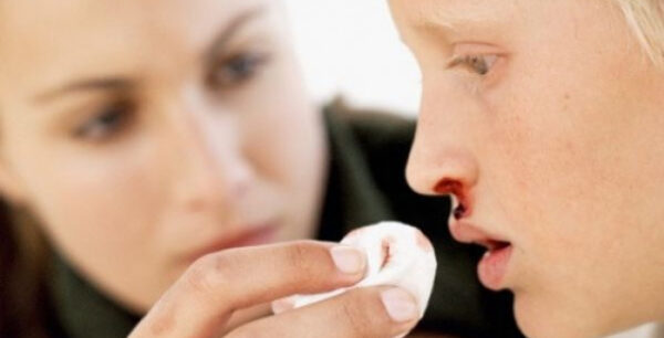 Πώς αντιμετωπίζεται η αιμορραγία από τη μύτη