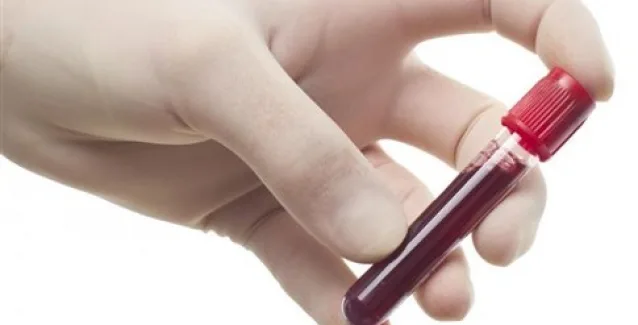 Το αυξημένο ουρικό οξύ μειώνει τον κίνδυνο νόσου Πάρκινσον