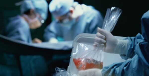 Η Ελλάδα έχει τους λιγότερους δότες νεφρού αναλογικά με τον πληθυσμό