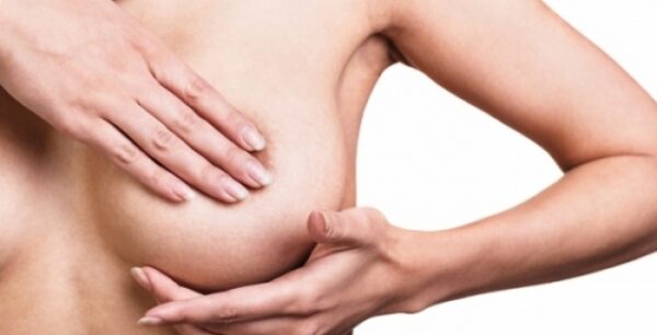 Καρκίνος μαστού και κληρονομικότητα: Οι τρεις απλές συνήθειες που θα σε προστατέψουν