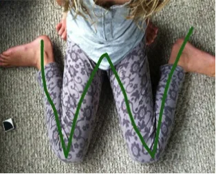 SOS ! Γιατί τα παιδιά δεν πρέπει να κάθονται σε θέση «W»!