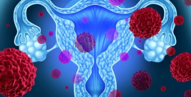 Καρκίνος των ωοθηκών: Με ποια διατροφή θα προστατευθείτε