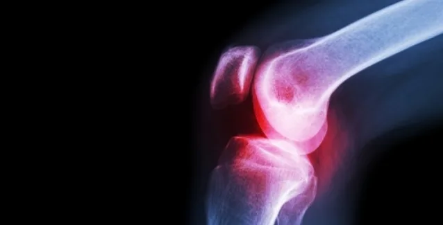 Αυτές είναι οι 3 τροφές που προκαλούν πόνους στις αρθρώσεις