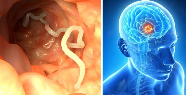 Τρώγοντάς το κινδυνεύετε να κάνετε σκουλήκια στον εγκέφαλο[Βίντεο]