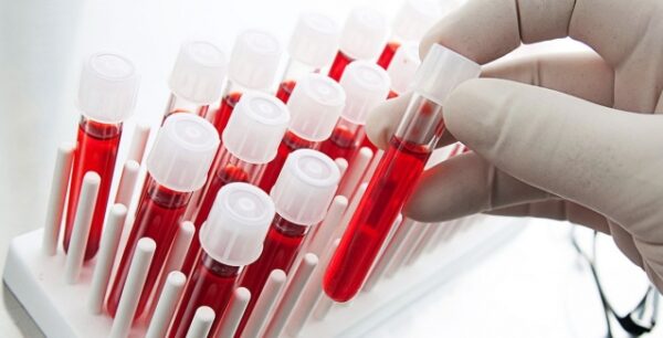 Ποιος είναι ο καθοριστικός παράγοντας που κάνει ανθρώπους με ομάδα 0 μοναδικούς