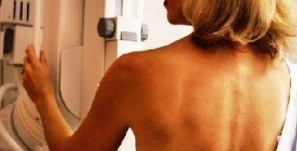 Γυναίκες με καρκίνο του μαστού καταφεύγουν σε δάνεια για να πληρώσουν τις πανάκριβες θεραπείες