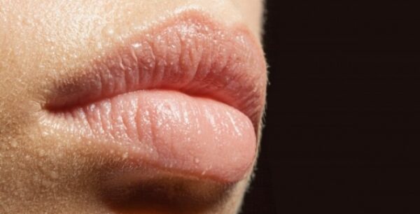 Ξηροστομία: Ποιες είναι οι επιπτώσεις στην υγεία, τι μπορείτε να κάνετεq