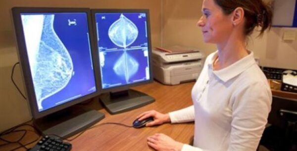 Καρκίνος Μαστού: Όσο γρηγορότερα η θεραπεία, τόσο καλύτερη η επιβίωση