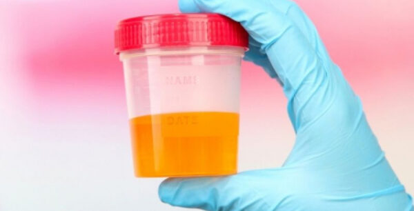 Ουρικό οξύ: Τι προκαλεί και πώς αντιμετωπίζεται