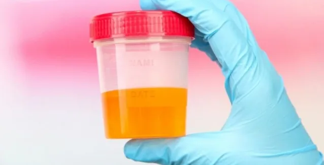 Ουρικό οξύ: Τι προκαλεί και πώς αντιμετωπίζεται