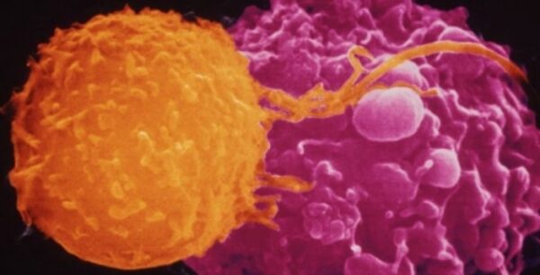 Σημαντικό βήμα για την αντιμετώπιση των αυτοάνοσων νοσημάτων