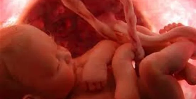 Μητρική παχυσαρκία και διαβήτης προκαλούν ταχεία εμβρυική ανάπτυξη