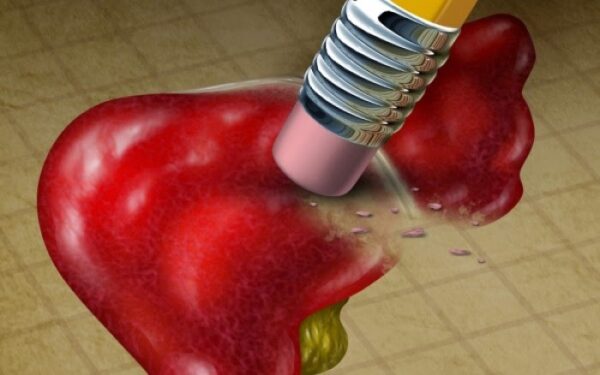 Αν κάνετε αυτά, καταστρέφετε σταθερά το συκώτι σας