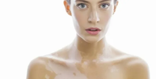 Απώλεια μελάγχρωσης του δέρματος:Αιτίες της νόσου