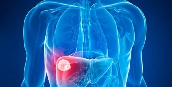 Αν δεις αυτά τα σημάδια, έλεγξε γρήγορα το συκώτι σου!