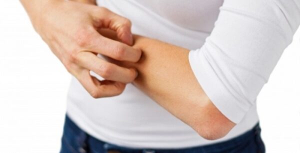 Το στρες επιδεινώνει τις δερματοπάθειες