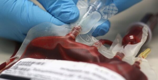 Σοβαρές οι ελλείψεις σε αίμα στα νοσοκομεία
