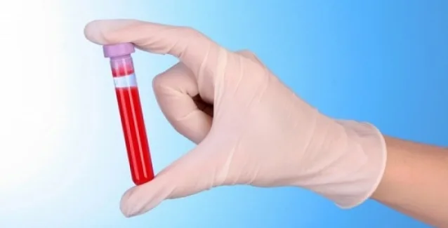 Η εξέταση αίματος που προλαμβάνει το έμφραγμα