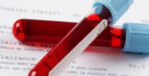 Αιματοκρίτης: Τι σημαίνει όταν είναι υψηλός και τι όταν είναι χαμηλός
