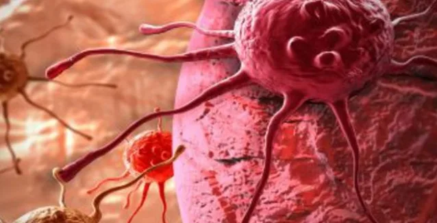 Ο καρκίνος του παχέος εντέρου «χτυπά» πλέον και πιο νέους