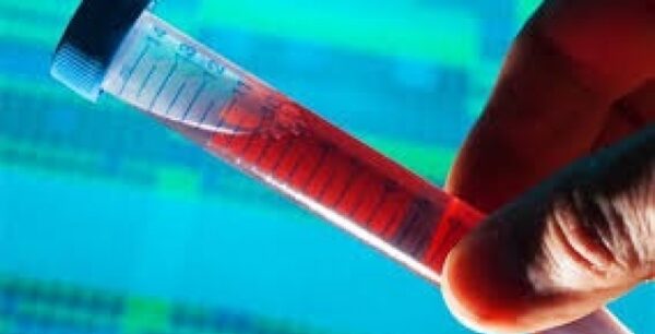 Δεν υπάρχει εξέταση αίματος που να αντικαθιστά την αμνειοπαρακέντηση