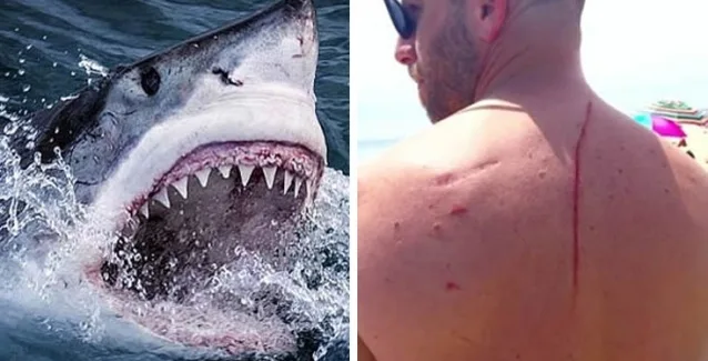 Άνθρωποι ανακάλυψαν ότι έχουν καρκίνο με τον πιο παράξενο τρόπο