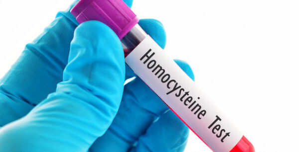Υψηλή ομοκυστεΐνη και καρδιαγγειακός κίνδυνος: Η διατροφή που τη ρυθμίζει