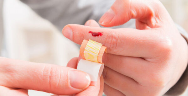 Το μπαχαρικό που σταματάει την αιμορραγία σε 10΄΄