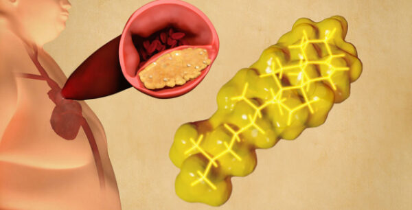 Ψάρια: Πόσο συχνά πρέπει να τρώτε για να μειώσετε χοληστερίνη και τριγλυκερίδια