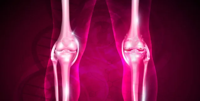 Για πρώτη φορά διάγνωση οστεοαρθρίτιδας στο γόνατο με τη βοήθεια μικροφώνου