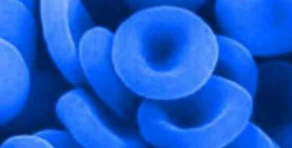 Στον κόσμο υπάρχουν περίπου 7000 άτομα με μπλε αίμα!