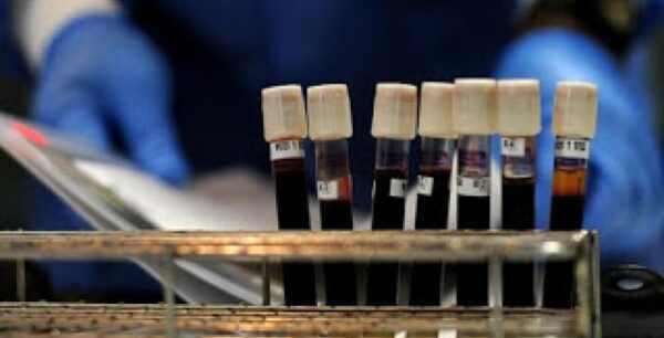 Από ποιες ασθένειες κινδυνεύετε ανάλογα με την ομάδα αίματός σας