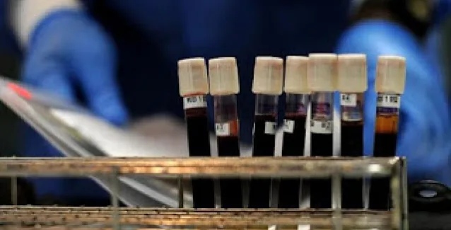 Από ποιες ασθένειες κινδυνεύετε ανάλογα με την ομάδα αίματός σας