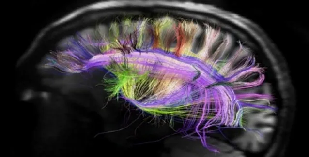 Οι εγκεφαλικές συνάψεις μάλλον υπεύθυνες για σχιζοφρένεια ή αυτισμό
