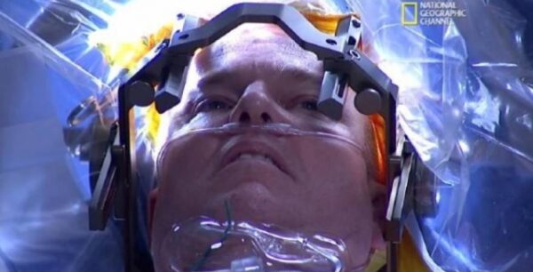 Μοναδικό: Η πρώτη live επέμβαση εγκεφάλου μεταδόθηκε στην τηλεόραση σε 171 χώρες