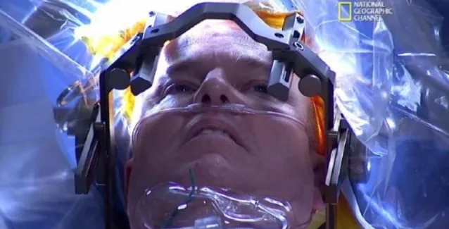 Μοναδικό: Η πρώτη live επέμβαση εγκεφάλου μεταδόθηκε στην τηλεόραση σε 171 χώρες