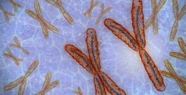 Η απώλεια του χρωμοσώματος Υ αυξάνει τον κίνδυνο νόσου Αλτσχάιμερ