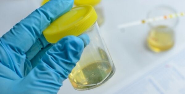 Ποια σοβαρή ασθένεια «προδίδει» η μυρωδιά των ούρων;