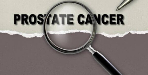 Καρκίνος του προστάτη: 9 οδηγίες για να μην εμφανίσετε ποτέ