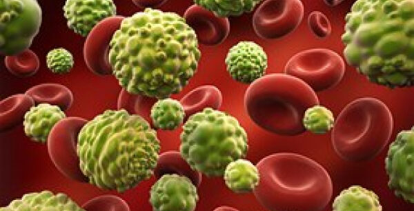 Βρέθηκε γονίδιο που «φρενάρει» τις μεταστάσεις καρκίνου