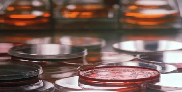 IBHS: Πτωτική η πορεία των διαγνωστικών κέντρων την τελευταία τριετία