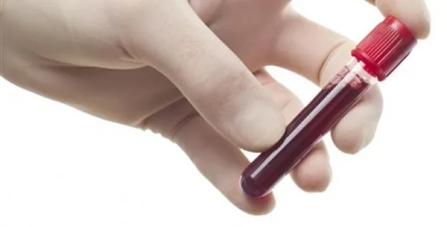 Υγρής μορφής βιοψία εντοπίζει μεταλλάξεις στους καρκινικούς όγκους