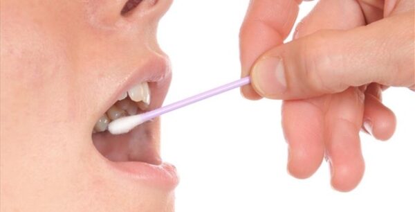 Πρόβλεψη της θνησιμότητας με τεστ σάλιου