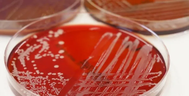 Elizabethkingia:Ένα βακτήριο, που βρίσκεται παντού και σκοτώνει