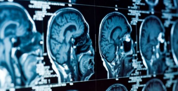 Τα Αρχαία Ελληνικά επαναπρογραμματίζουν τον εγκέφαλο