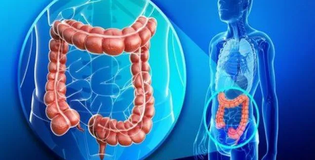 Καρκίνος του παχέος εντέρου: Η μεγάλη διαφορά αν αναπτυχθεί στην αριστερή ή στη δεξιά πλευρά!