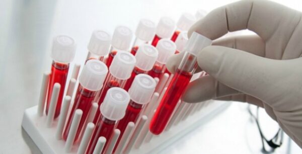 Με τεστ αίματος η διάγνωση και αποτελεσματική καταπολέμηση της κατάθλιψης