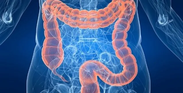 Πρωτεΐνη καθορίζει τη βέλτιστη θεραπεία για τον καρκίνο παχέος εντέρου