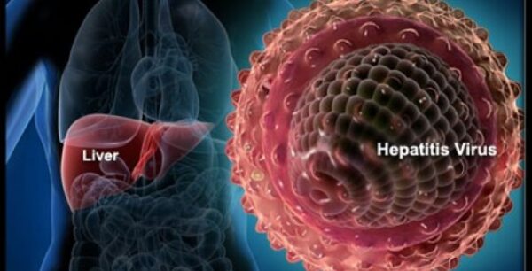 Ηπατίτιδα C: Νέα θεραπεία επιτυγχάνει υψηλά ποσοστά ιολογικής ανταπόκρισης