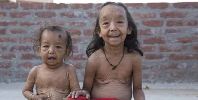 Πάσχουν από την επώδυνη προγηρία, αλλά δεν έχουν πάψει να ελπίζουν